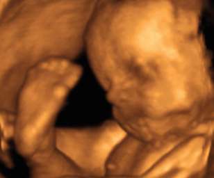 ultrasound of human fetus 29 weeks and 6 days