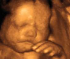 ultrasound of human fetus 30 weeks and 3 days