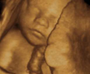 ultrasound of human fetus 30 weeks and 6 days