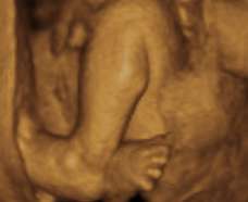ultrasound of human fetus 31 weeks exactly
