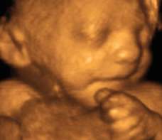 ultrasound of human fetus at 32 weeks and 6 days