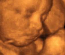 ultrasound of human fetus at 33 weeks exactly