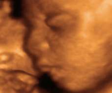 ultrasound of human fetus 36 weeks exactly