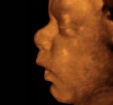 ultrasound of human fetus 36 weeks and 5 days