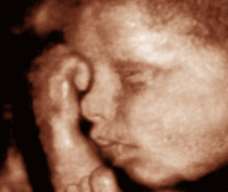 ultrasound of human fetus 37 weeks and 5 days