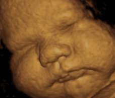 ultrasound of human fetus 40 weeks exactly