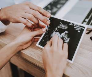 11 week fetus ultrasound photo 