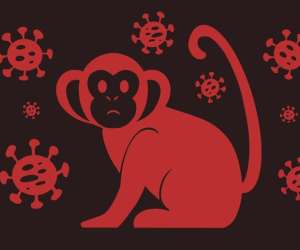 Monkeypox outbreak