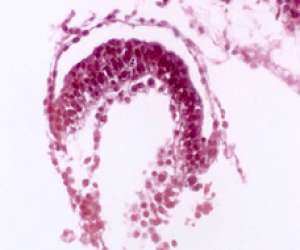 amniotic cavity of embedded blastocyst
