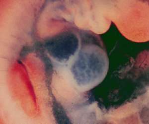 heart of human embryo at 6 weeks and 6 days
