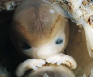 human embryo at 7 weeks and 2 days