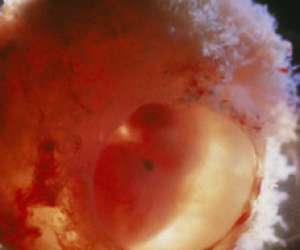 ultrasound of human embryo at 8 weeks and 1 day