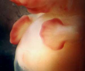 hands of human embryo at 8 weeks and 4 days