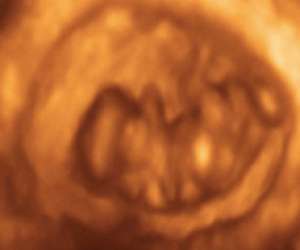 ultrasound of human embryo at 8 weeks and 6 days