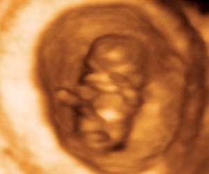 ultrasound of human fetus at 9 weeks and 3 days