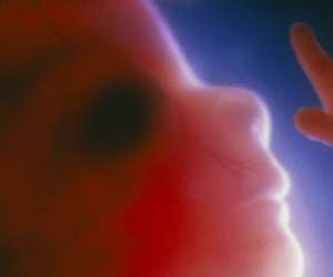 face of human fetus at 9 weeks and 4 days