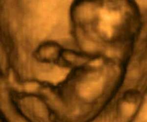 ultrasound of human fetus at 12 weeks and 1 day