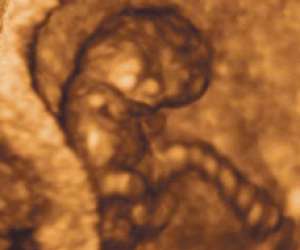 ultrasound of human fetus at 12 weeks and 2 days