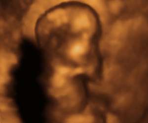 ultrasound of human fetus at 12 weeks and 4 days