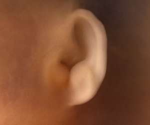 ear of human fetus at 13 weeks and 3 days
