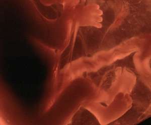 ultrasound of human fetus at 13 weeks and 4 days