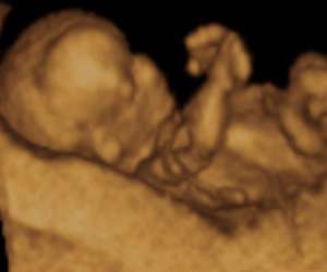 ultrasound of human fetus at 14 weeks and 2 days