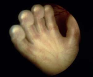 hand of human fetus at 14 weeks and 3 days