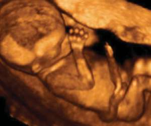 ultrasound of human fetus at 14 weeks and 5 days