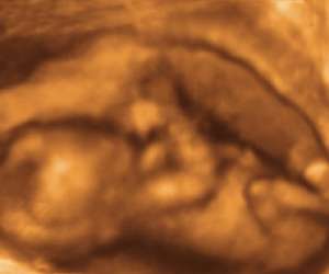 ultrasound of human fetus at 15 weeks and 6 days