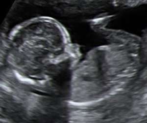 ultrasound of human fetus at 16 weeks and 4 days