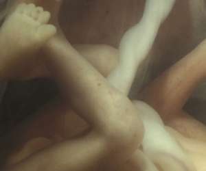 ultrasound of human fetus at 17 weeks and 2 days