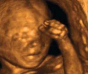 ultrasound of human fetus at 17 weeks and 5 days