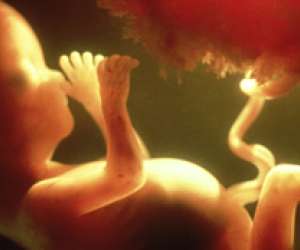 human fetus and placenta at 18 weeks and 1 day