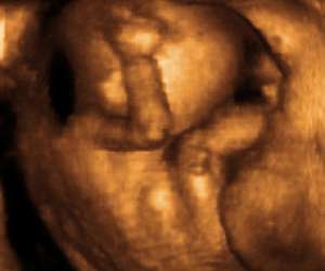 ultrasound of human fetus at 18 weeks and 2 days