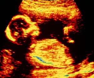 ultrasound of human fetus at 18 weeks and 4 days
