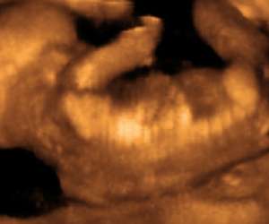 ultrasound of human fetus at 18 weeks and 6 days