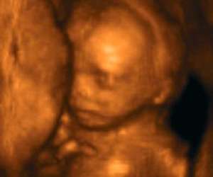 ultrasound of human fetus at 19 weeks and 5 days