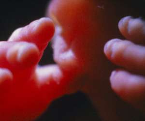 finger tips of human fetus at 20 weeks and 2 days