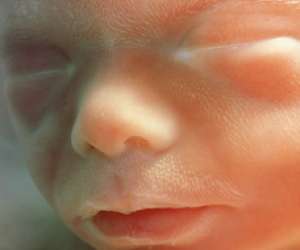 face of human fetus at 20 weeks and 3 days