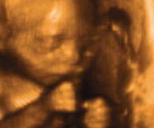 ultrasound of human fetus at 23 weeks and 1 day