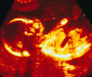 ultrasound of human fetus at 23 weeks and 2 days