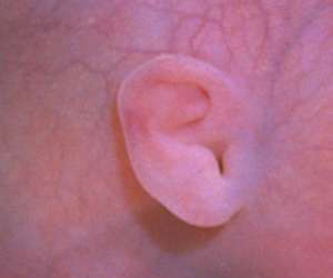 ear of human fetus at 24 weeks and 2 days