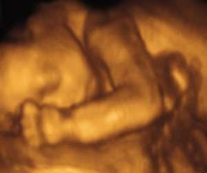 ultrasound of human fetus at 24 weeks and 3 days