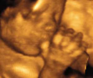 ultrasound of human fetus at 24 weeks and 4 days