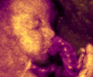 ultrasound of human fetus at 25 weeks and 2 days