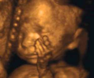 ultrasound of human fetus at 25 weeks and 5 days