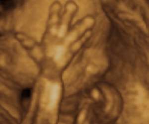 ultrasound of human fetus as 26 weeks and 4 days