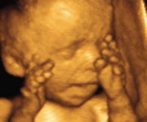 ultrasound of human fetus as 27 weeks and 2 days