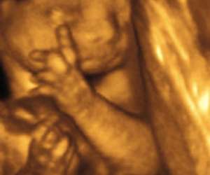 ultrasound of human fetus as 27 weeks and 5 days