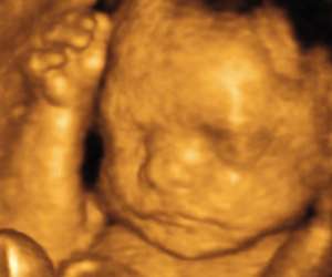 ultrasound of human fetus as 28 weeks and 2 days
